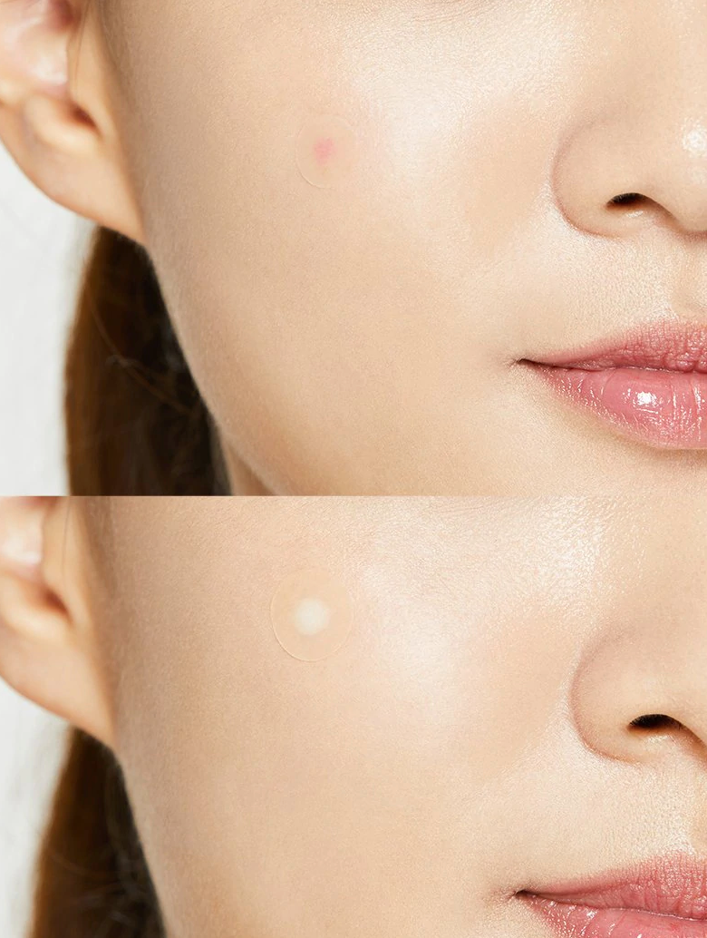 COSRX - Acne Pimple Master Patch